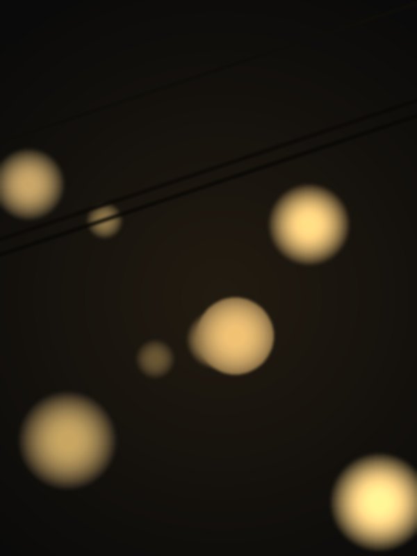 Hair restoration journey