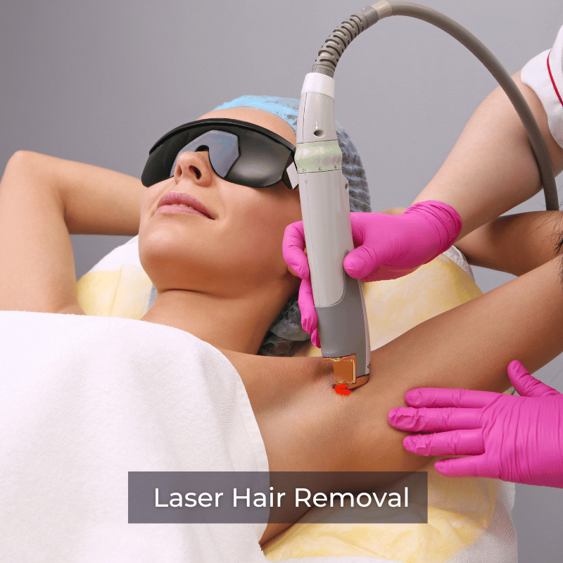 Laser Hair Removal